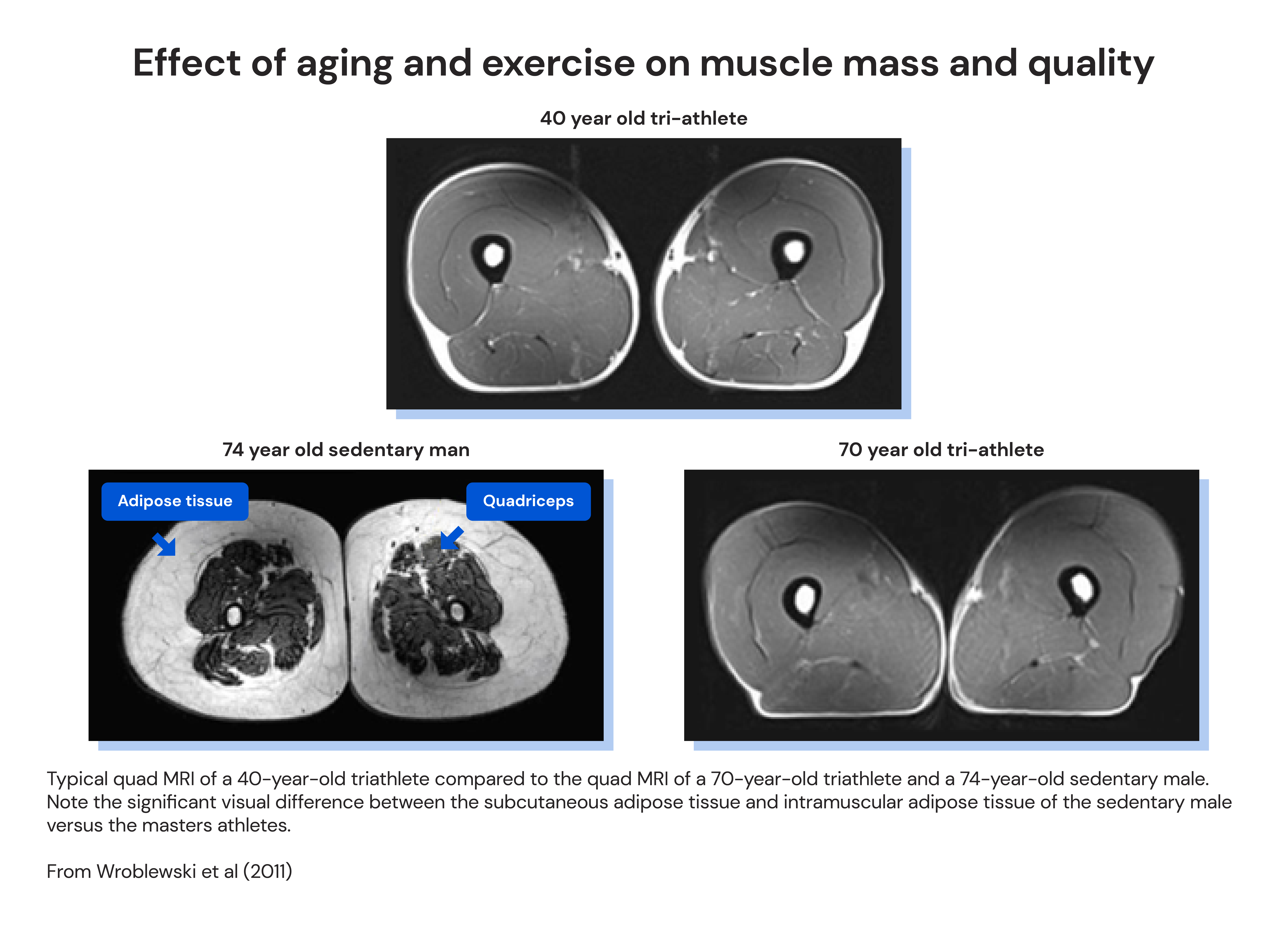 Effect of aging and exercise on muscle mass and quality