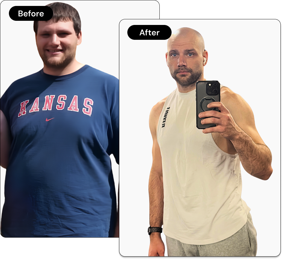 Nic Before and After